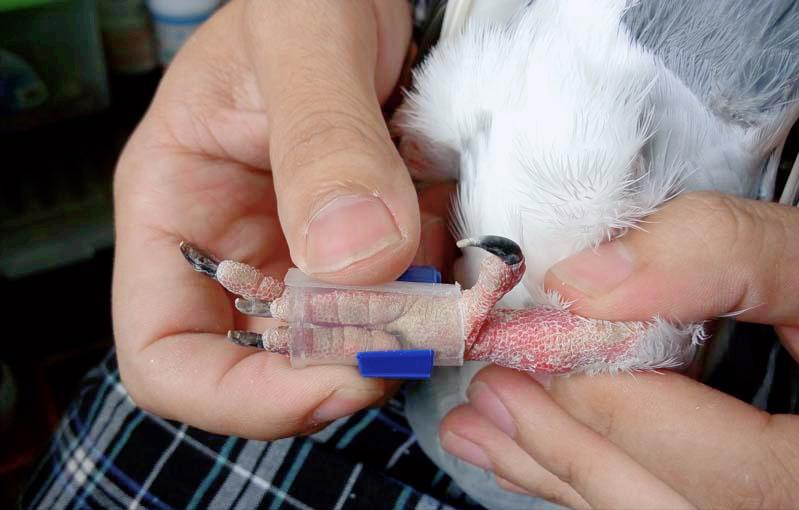 看了日本这个上环器我终于有勇气把这个分享给您