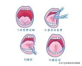 宝宝的舌头有点红怎么回事,宝宝的舌头有红点