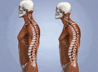 真翘臀和假翘臀怎么辨别,怎样判断翘臀是不是假的