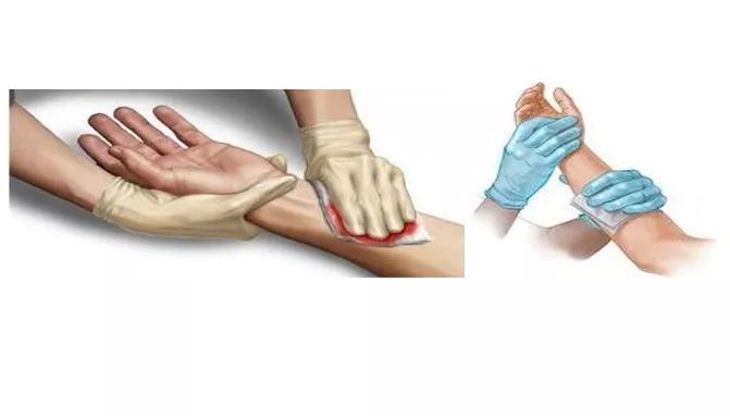 运动损伤的治疗与康复知识点,运动损伤的诊治