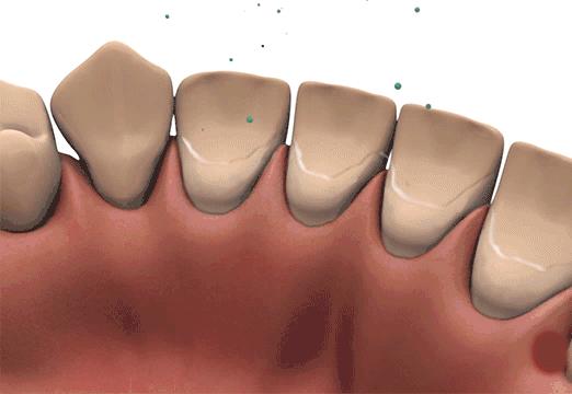 淄博诺尔漫口腔医院电话,淄博诺尔漫齿科