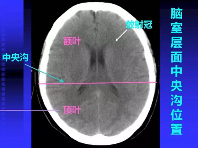 头颅mri读片视频教程,颅脑mri读片入门教程视频讲解全集