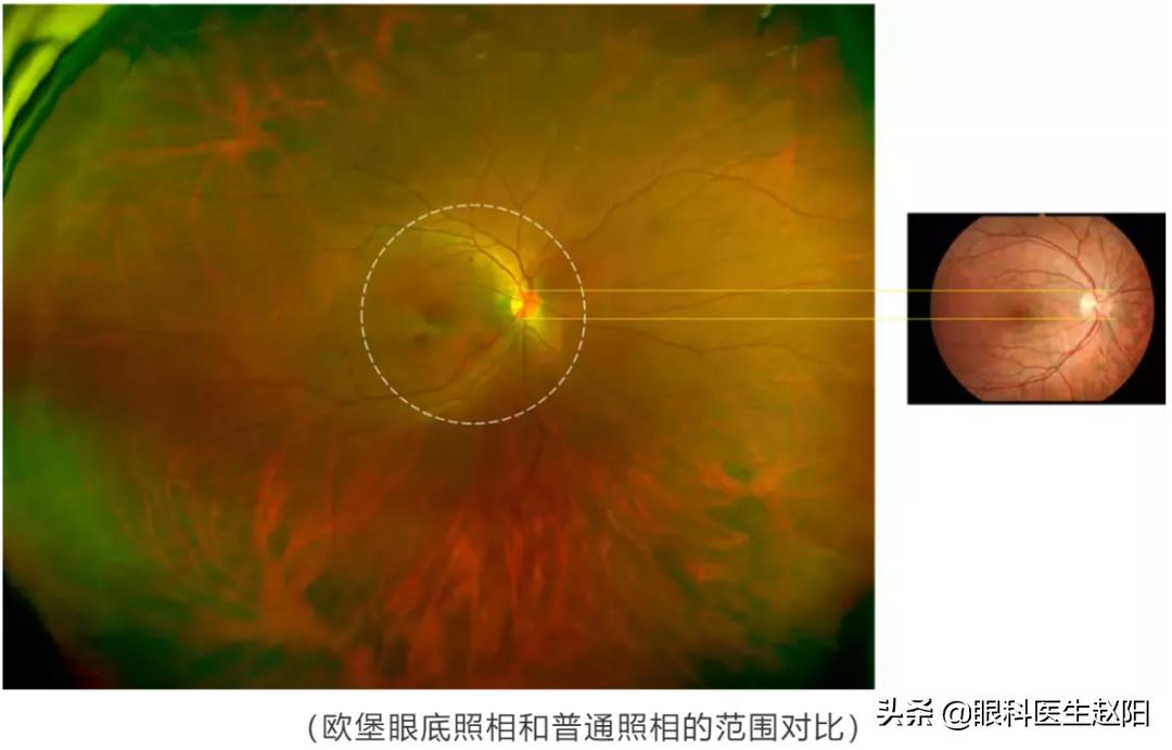 吹哨为什么会漏哨,吹哨是不是就犯规了