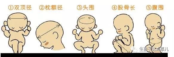 四维b超单子右上角字母f代表什么,b超单子字母都分别代表什么