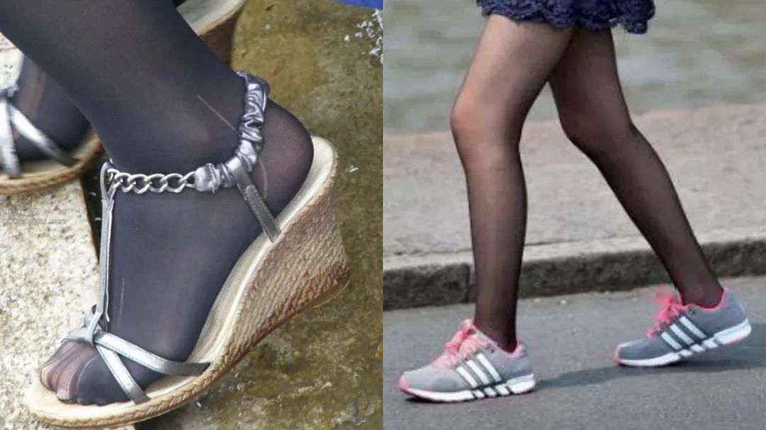 杨幂的腿弯什么原因,杨幂的筷子腿为啥那么细