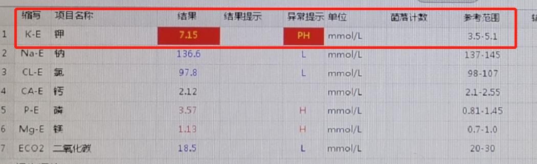 血透内瘘球囊扩张术痛吗,血透导管堵塞如何溶栓
