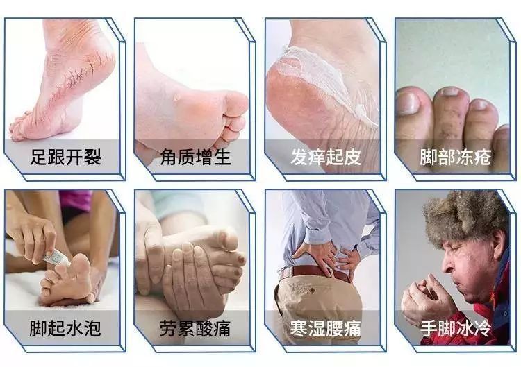 暖脚高科技,暖脚宝黑科技