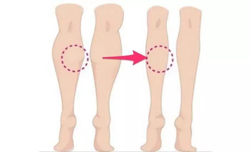 腿型不好会显短吗,牛仔裤哪个版型显高显瘦修饰腿型