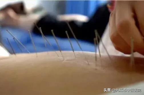 针灸减肥和埋线减肥哪个容易反弹,针灸埋线减肥是通过什么原理减肥