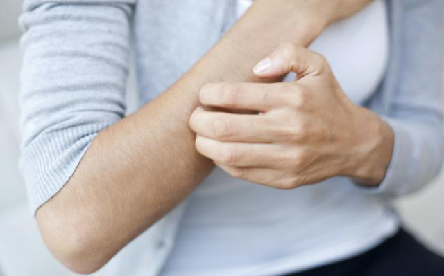 次氯酸皮肤病,氯雷他定治湿疹的最佳方法