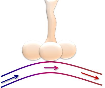 新冠肺炎机械通气系列课程(讲义)-阻塞性肺病的机械通气