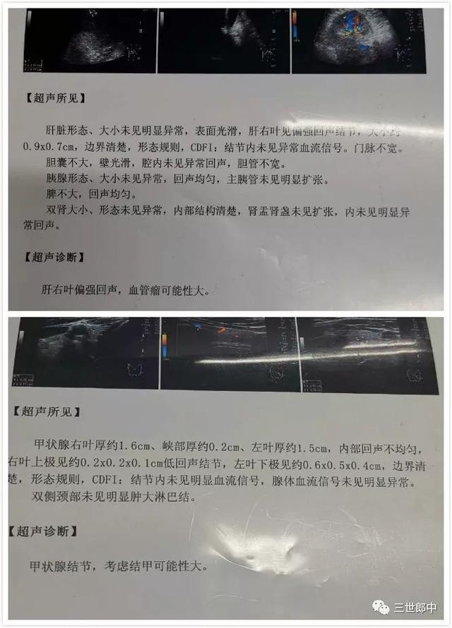 软坚散结专治癌症结节,病理检查发现结节是癌症吗