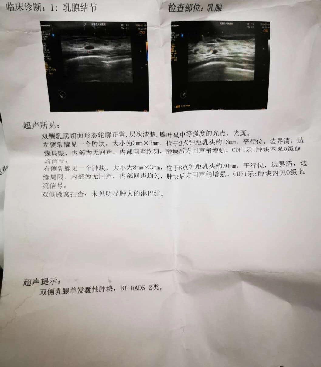 子宫内膜薄咽炎乳腺增生结节,鼻咽炎睡眠呼吸暂停综合征