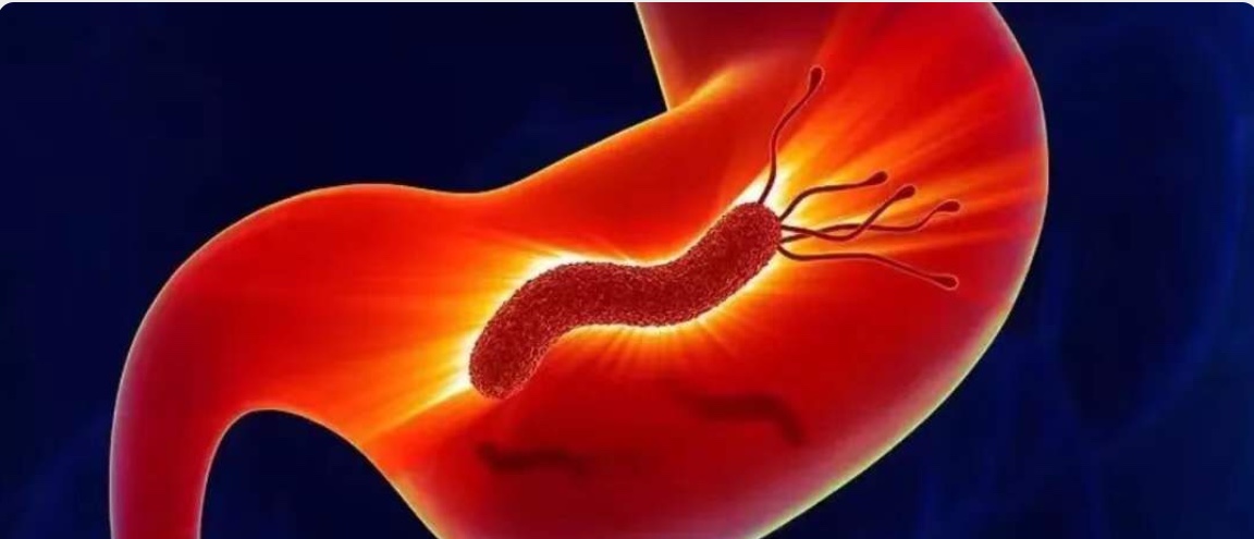 慢性浅表性胃炎到底要不要治疗,慢性浅表性萎缩胃炎怎么治疗断根