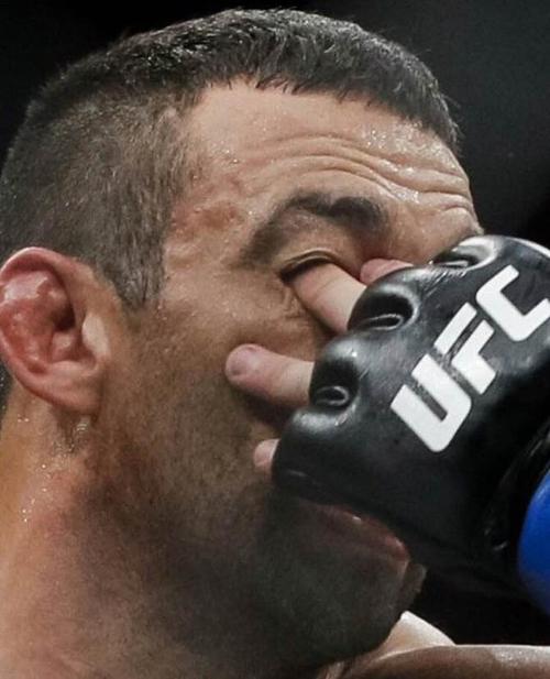 打架插眼，到底是雕虫小技，还是绝杀大招？