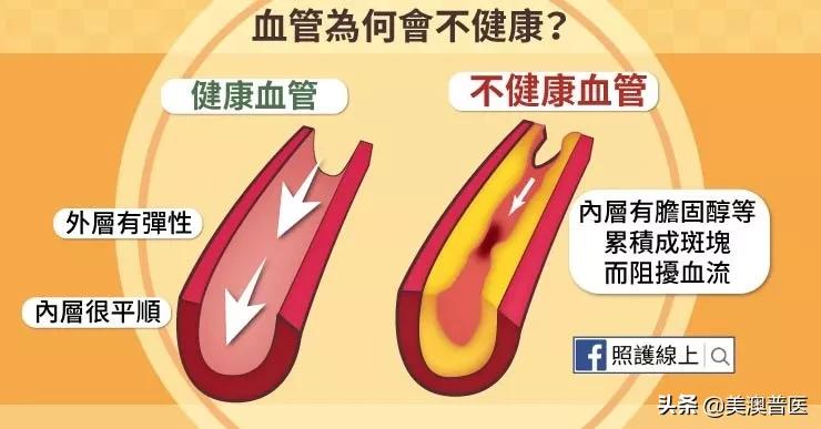 心脏缺血得注意保暖,心脏缺血该怎么安慰