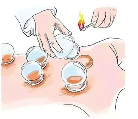 千寒易除一湿难去教你一招,千寒易除一湿难去怎么办