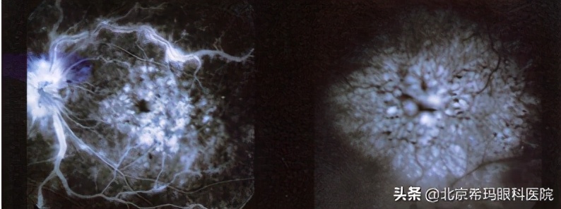 定期查眼底要专家门诊吗,查眼底查哪一项能查出来