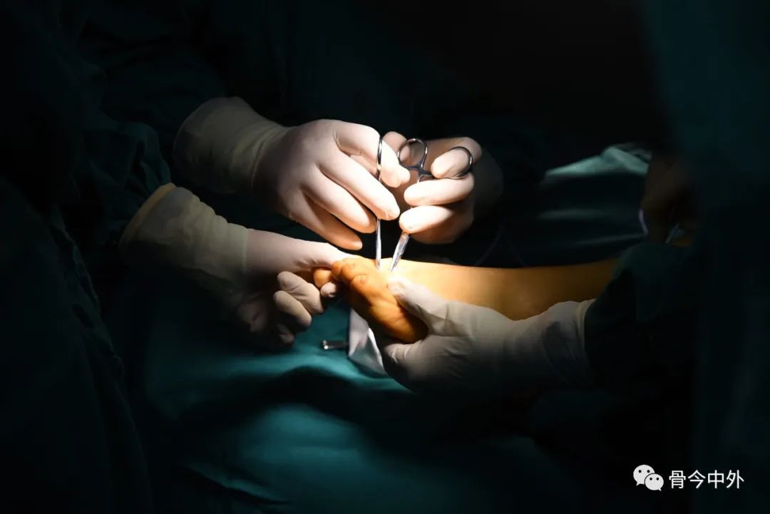 【积水成潭】揭秘北京积水潭医院足踝外科