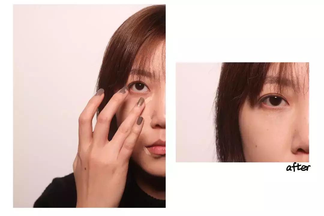 缇庡鐨偆绠＄悊鍖栧,缇庡闄㈠仛鑲岃偆閬憰