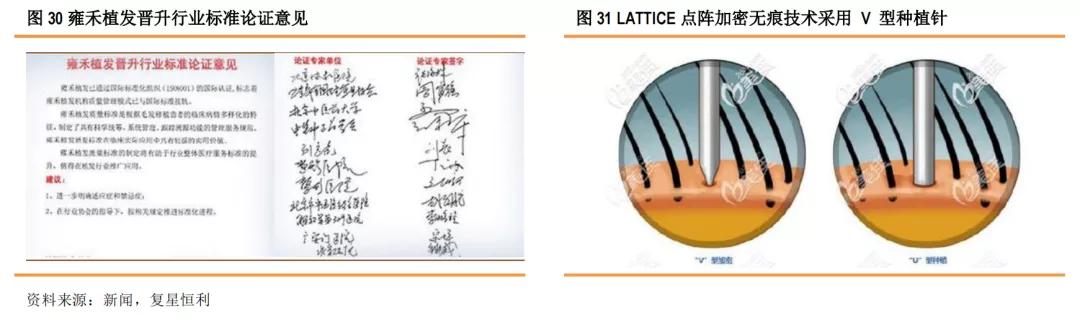 星研究,医疗美容植发四大龙头