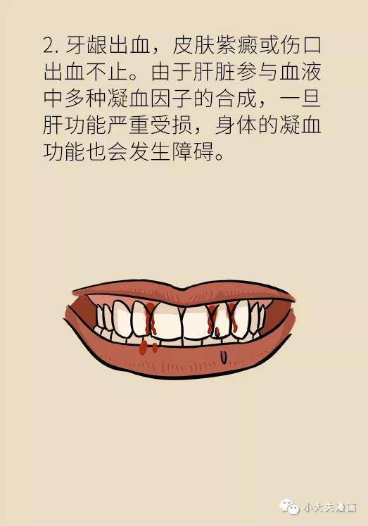 经常洗牙为什么牙周还是肿,经常洗牙会牙龈萎缩吗