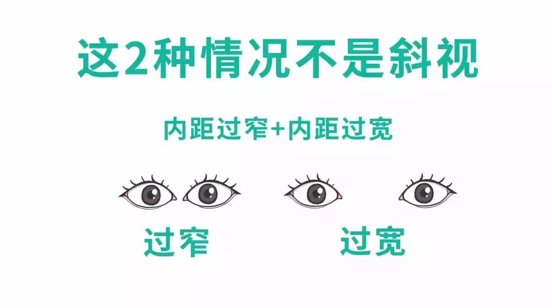 教你一招辨别宝宝真假斗鸡眼,怎么辨别自己眼睛不是斗鸡眼