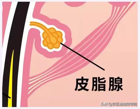 “毛孔粗大”粗的并不是“毛孔”,它是瘢痕呀！三种方法有效解决