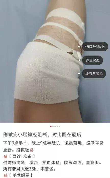 被整容害惨的网红,被整容毁掉的女明星