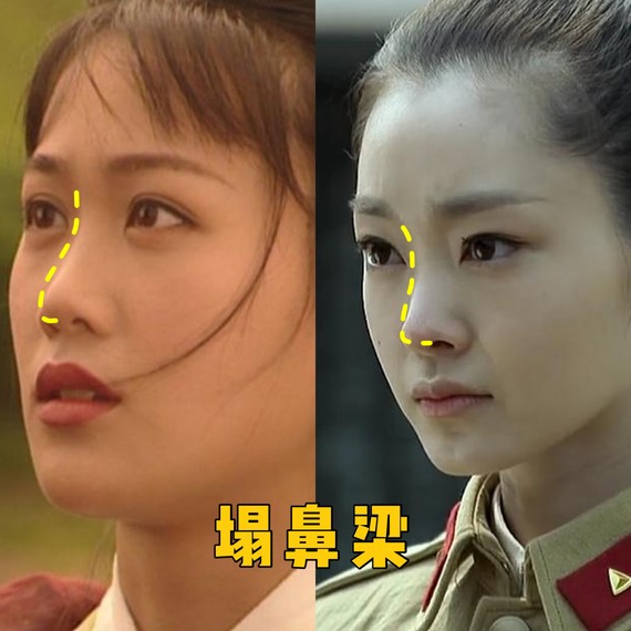 好看的鼻子类型驼峰鼻,好看的鼻型有哪几种