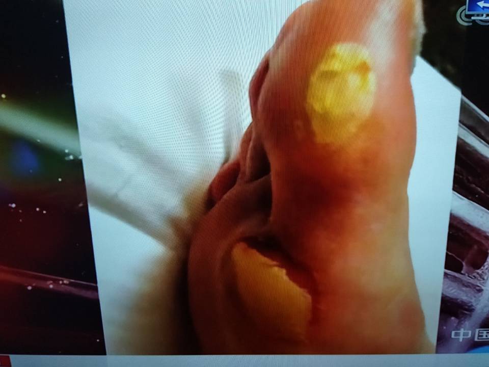 石宇奇打董新尧,世锦赛石宇奇vs桃田贤斗