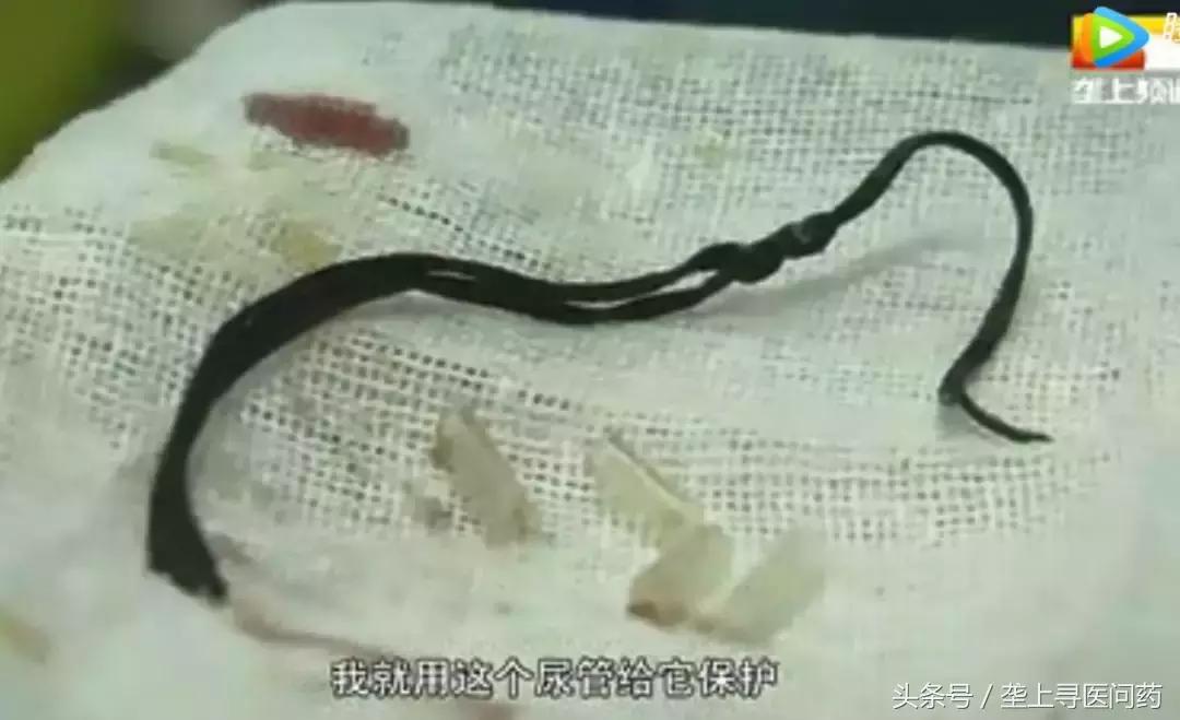 怀孕13周孩子会自然掉出来吗,孕中期觉得孩子要掉出来