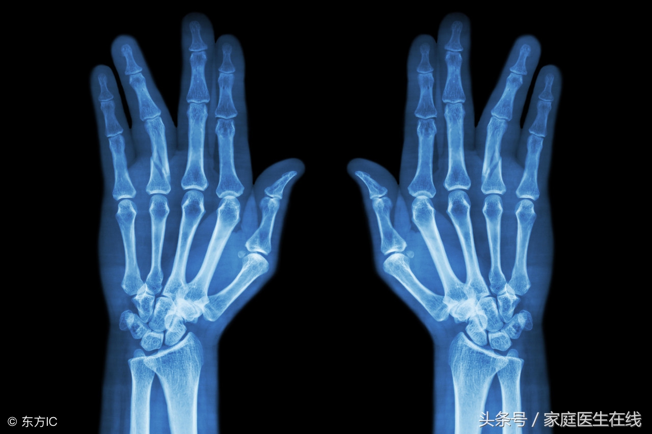 自测缺钙的方法,如何自测是否儿童缺钙缺锌