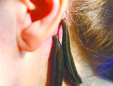 小时候田里的蚂蟥简直是噩梦,小时候最怕的蚂蝗