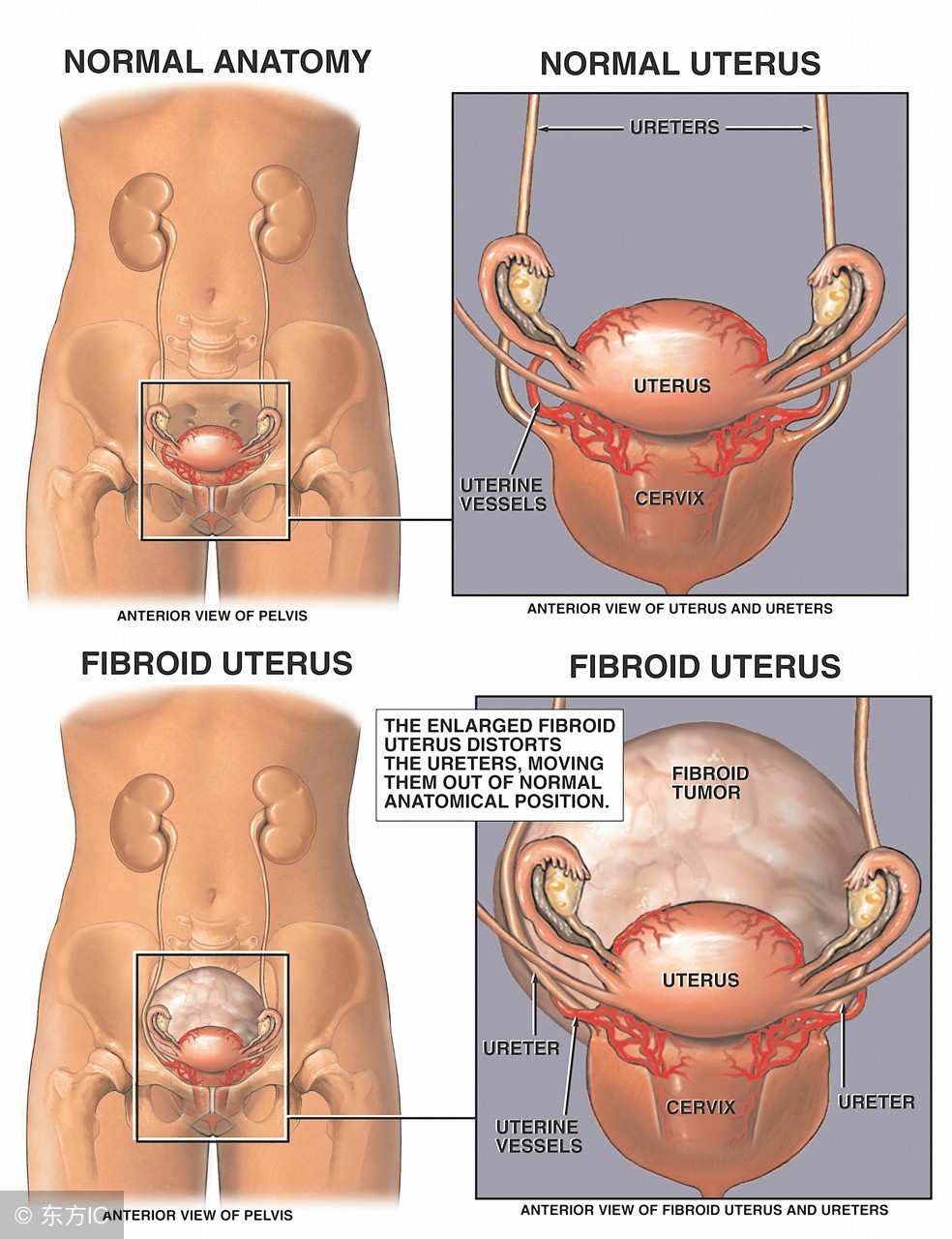 没结婚的女性会有宫颈糜烂吗,女生没结婚会得阴道炎吗