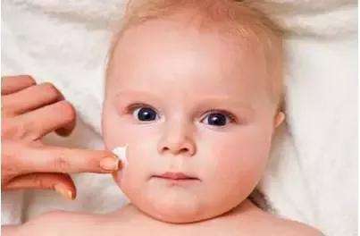 过敏性湿疹能用母乳涂抹吗,过敏性湿疹和母乳有关系吗