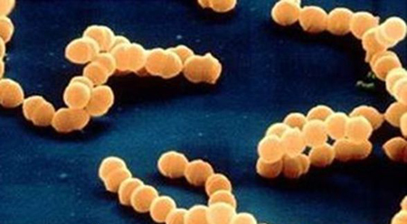 抗生素一定是真菌产生的吗,抗生素的药一定要做皮试吗