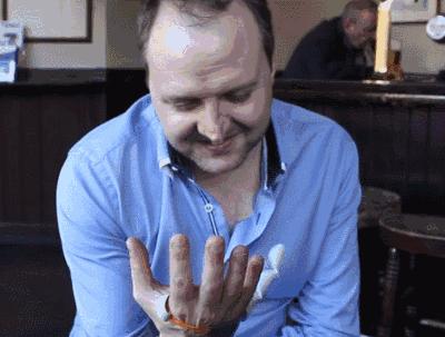 快速成型3d打印,3d打印再造手指技术