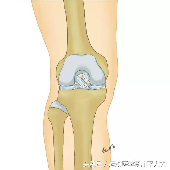 盘状半月板撕裂缝了3针,半月板撕裂应该避免做哪些动作