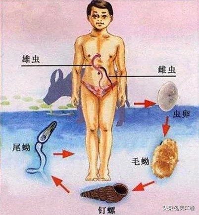 我经历“送瘟神”的时光