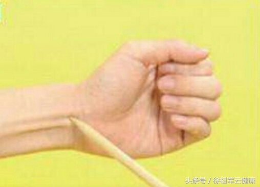 送你7把金钥匙让你时来运转,治疗失眠穴位和方剂