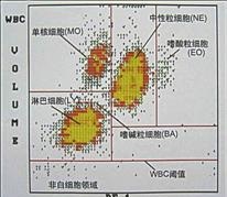 儿童血常规化验单怎么看白细胞,血常规化验单白细胞和超敏关系