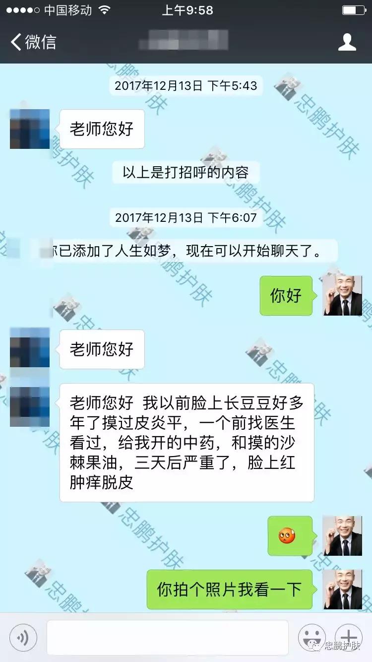 激素脸发红发热脱皮怎么办呢,激素脸为什么会扩散到脖子上代谢