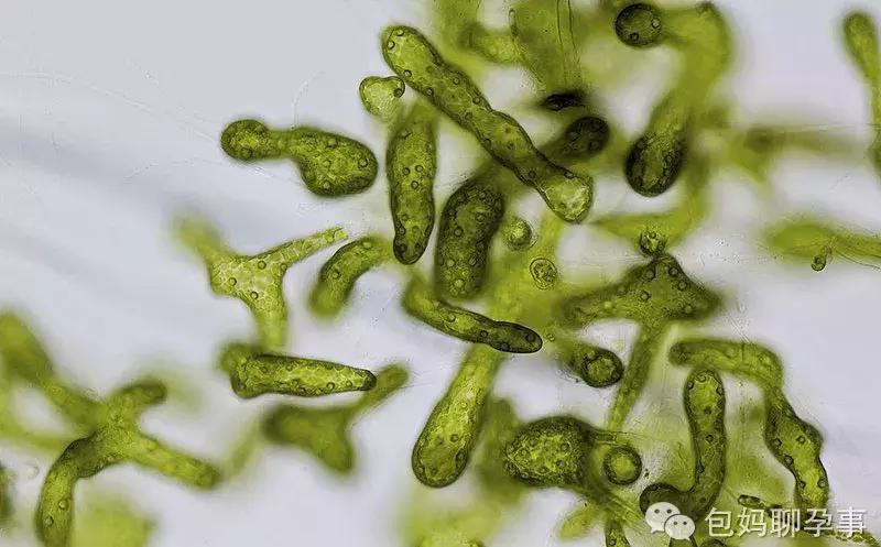 一孕傻三年是因为缺乏dha吗 (孕早期dha什么样的好)