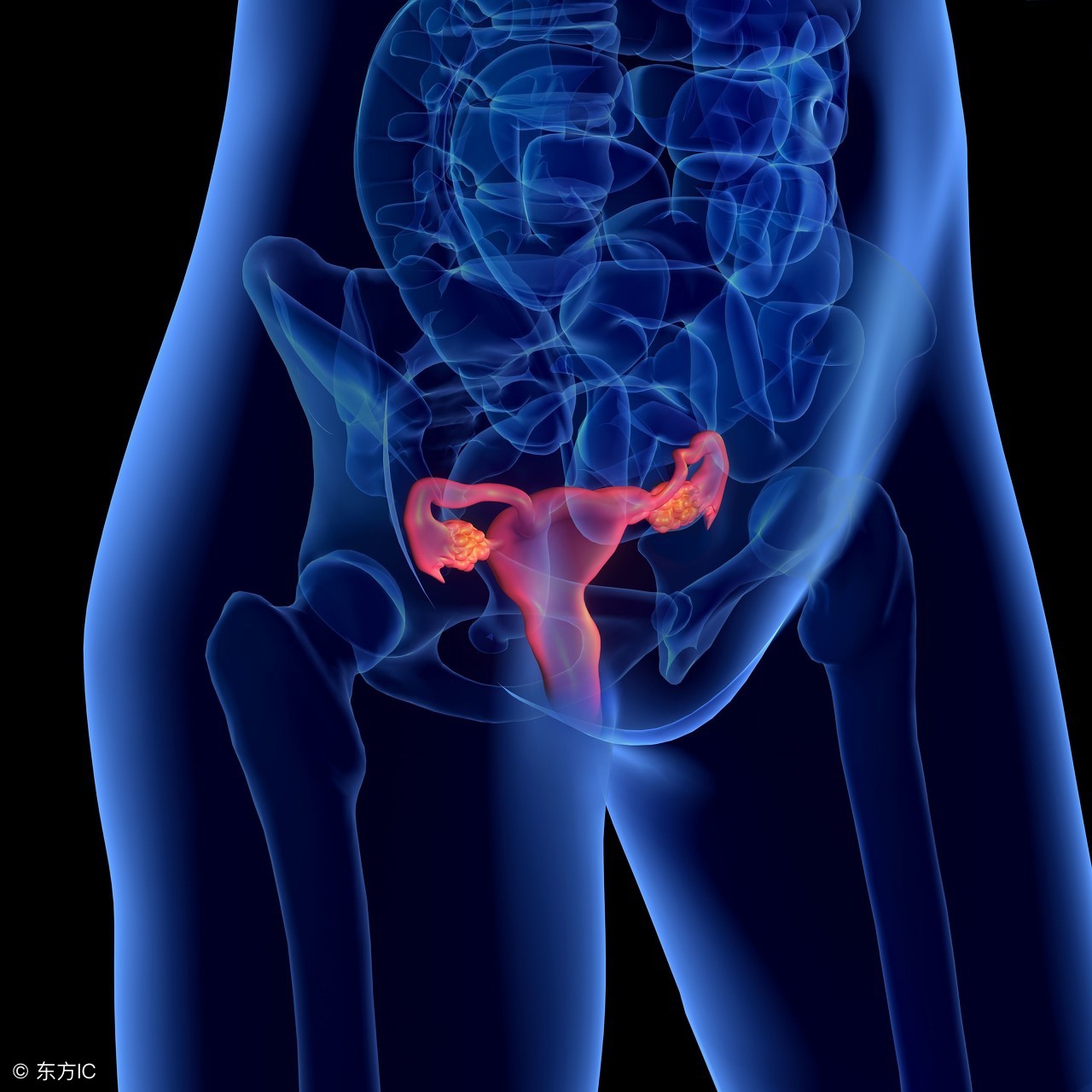 卵巢早衰ca125值升高,怀孕引起卵巢囊肿伴随ca125升高