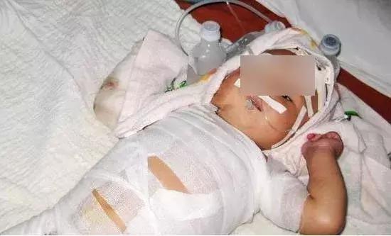 无知家长给孩子生吃蝌蚪,幼童被喂活蝌蚪民间偏方不可取