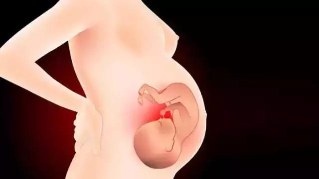 不想让胎宝宝提前发动,胎宝胎动频繁不舒服原因