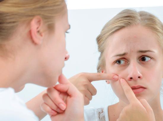 一个星期去闭口大作战！原来用这些“水”那么简单就去闭口了！