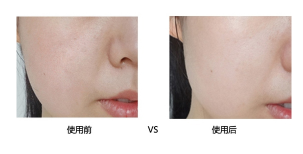 适合湿敷的去闭口的水推荐,一个星期祛闭口