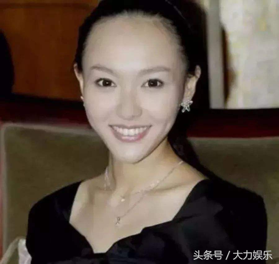 郭碧婷发际线,郭碧婷素颜现身无人识